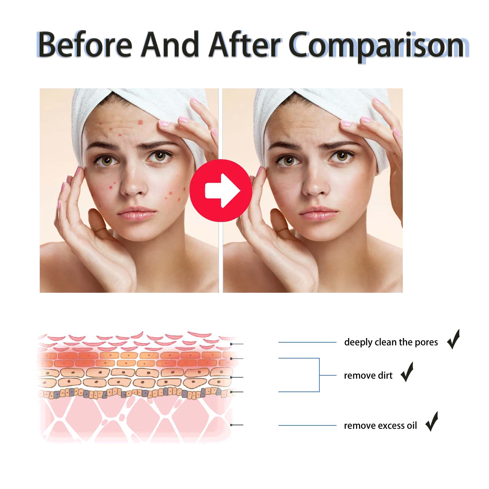2% ซาลิไซลิก แอซิด ลิควิด เอ็ก - Tranexamic Acid Serum บทวิจารณ์และราคา