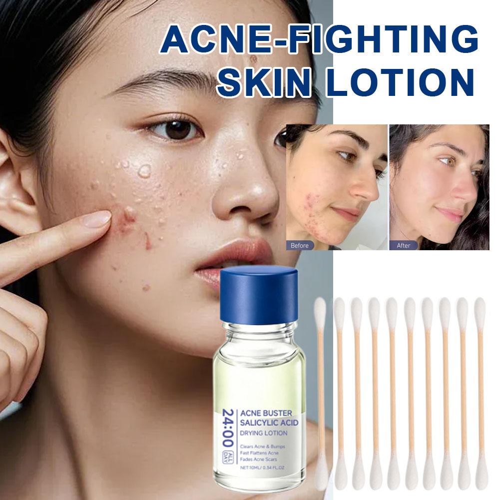 ซาลิไซลิก แอซิด เอสเซ้นส์ ทรีท - Tranexamic Acid Serum บทวิจารณ์และราคา