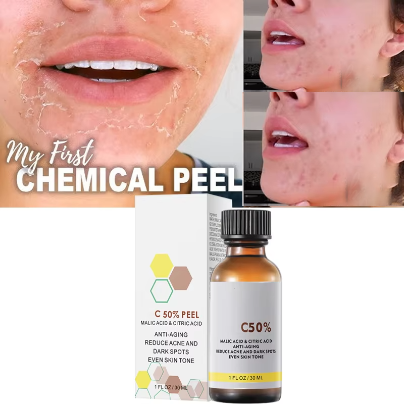 ด้วย Malic Acid และกรดซิตริกสํ - Tranexamic Acid Serum บทวิจารณ์และราคา