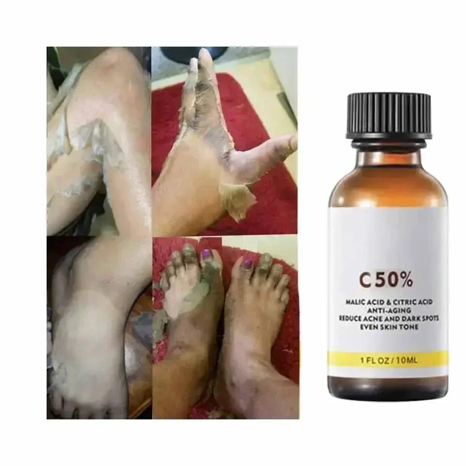 ด้วย Malic Acid และกรดซิตริกสํ - Tranexamic Acid Serum บทวิจารณ์และราคา